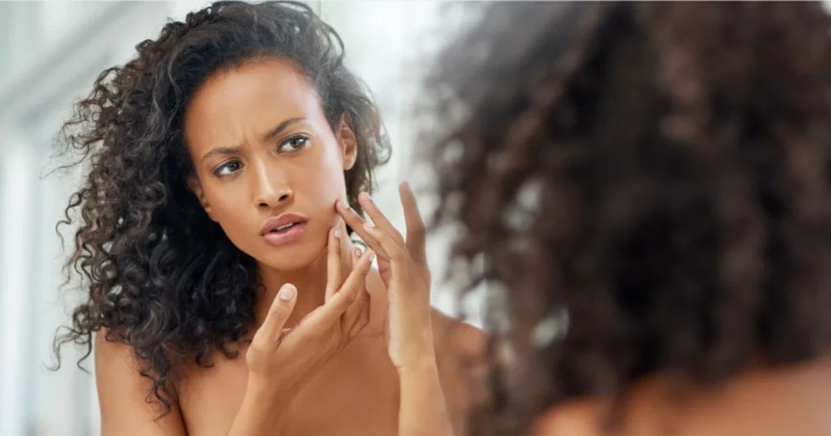 Tanning Indian Skin FAQ: Causes, Effects & Solutions for Teens