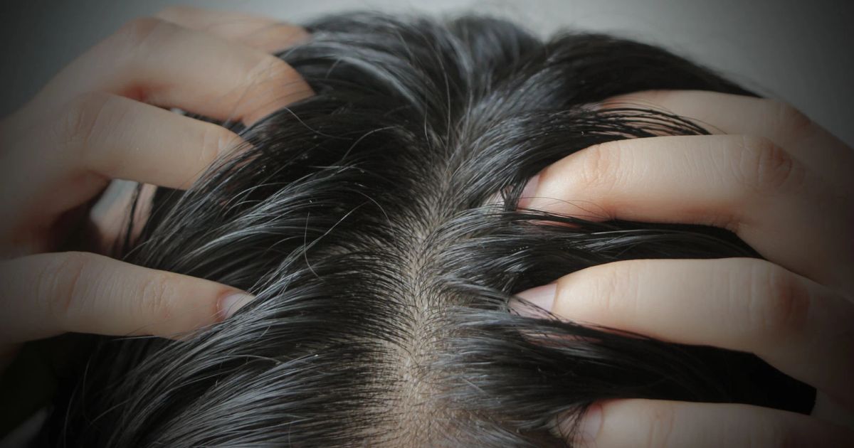 11 Trattamenti efficaci per rinforzare la crescita dei capelli e contrastare la caduta.