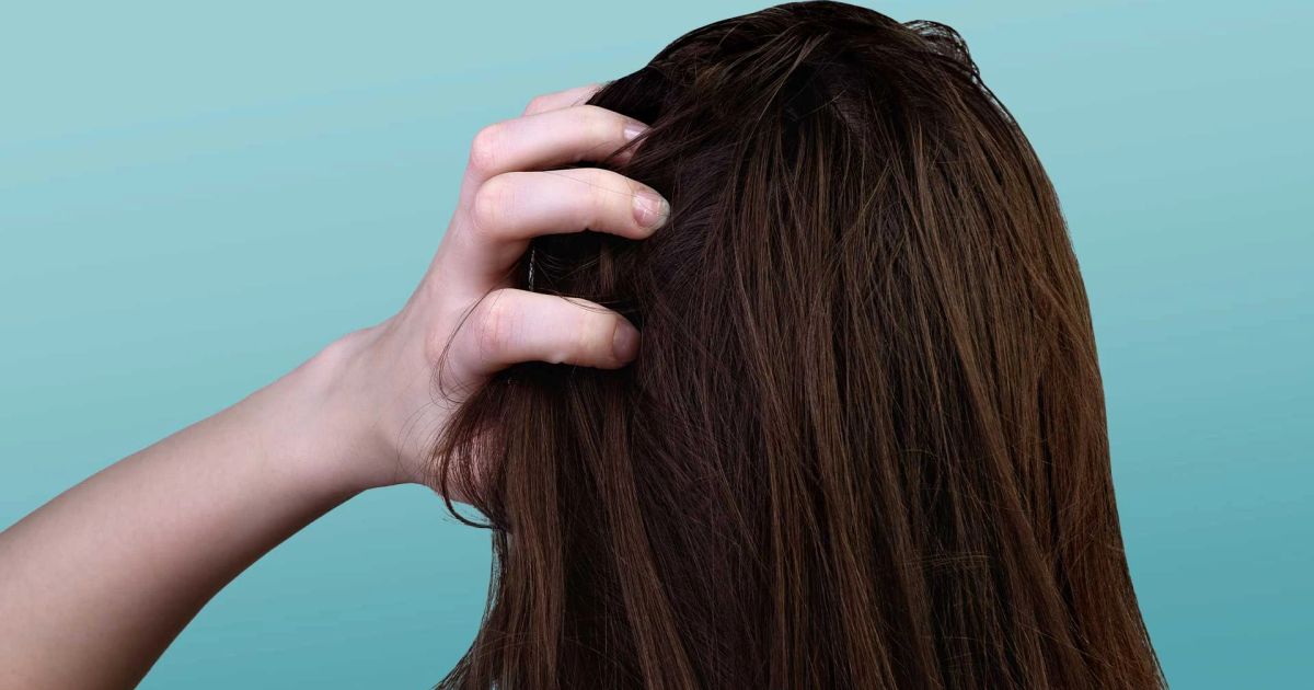 How to Relieve an Itchy Scalp: Expert Tips and Remedies