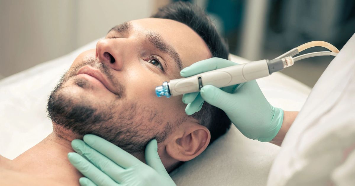 Crema depilatoria viso per pelli sensibili: tutto ciò che devi sapere.
