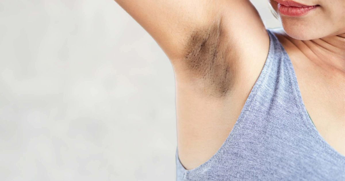 How to Choose the Best Underarm Cream for Brightening
