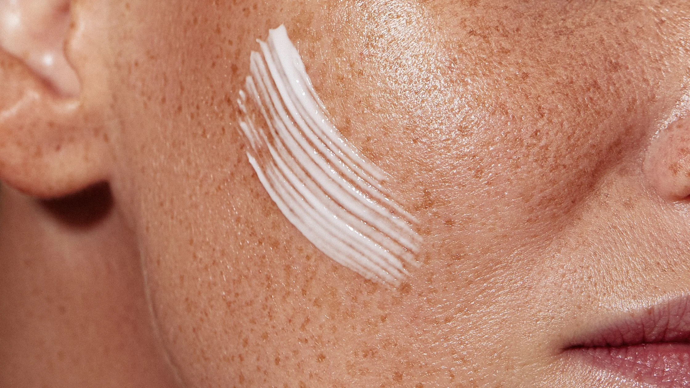 Hyaluronic Acid: What to Expect in 2 Weeks