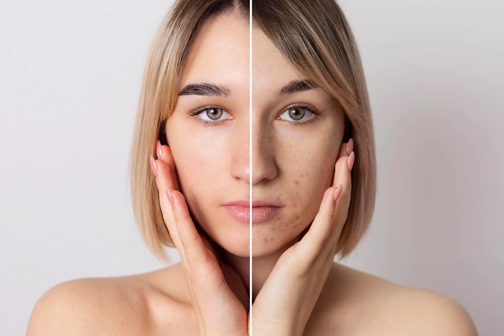 How to Choose the Best Collagen Supplements for Skin